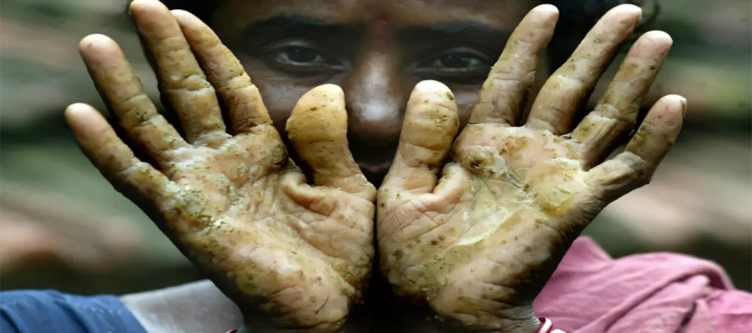 Hậu quả tiêu cực của ô nhiễm môi trường 